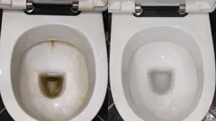 Von lästigen gelben Flecken bleibt keine Spur: Merken Sie sich diese 3 Methoden zur Reinigung des WCs